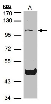 NALP3 / NLRP3 Antibody - Sample (30 ug of whole cell lysate). A: Raji. 7.5% SDS PAGE. NALP3 / NLRP3 antibody diluted at 1:1500