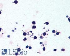NALP3 / NLRP3 Antibody - NALP3 / NLRP3 antibody (5µg/ml) staining of paraffin embedded Human Peripheral Blood Leukocytes. Steamed antigen retrieval with citrate buffer pH 6, AP-staining.