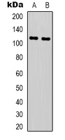 NALP3 / NLRP3 Antibody - Western blot analysis of NLRP3 expression in SHSY5Y (A); THP1 (B) whole cell lysates.
