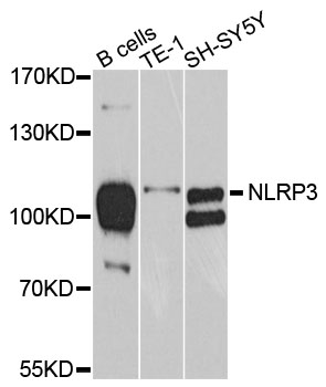 NALP3 / NLRP3 Antibody - Western blot analysis of extracts of various cell lines.