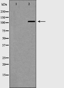 NALP3 / NLRP3 Antibody - Western blot analysis of extracts of K562 cells using NLRP3 antibody. The lane on the left is treated with the antigen-specific peptide.