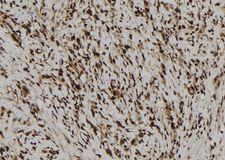 NALP3 / NLRP3 Antibody - 1:100 staining human gastric tissue by IHC-P. The sample was formaldehyde fixed and a heat mediated antigen retrieval step in citrate buffer was performed. The sample was then blocked and incubated with the antibody for 1.5 hours at 22°C. An HRP conjugated goat anti-rabbit antibody was used as the secondary.