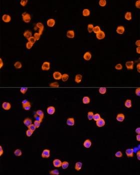 NALP3 / NLRP3 Antibody - Immunofluorescence analysis of Raw264.7 cells using NLRP3 Polyclonal Antibody at dilution of 1:100.Blue: DAPI for nuclear staining.