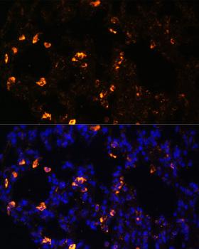NALP3 / NLRP3 Antibody - Immunofluorescence analysis of Rat lung cells using NLRP3 Polyclonal Antibody at dilution of 1:100.Blue: DAPI for nuclear staining.