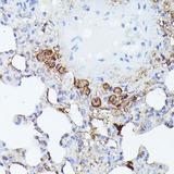 NALP3 / NLRP3 Antibody - Immunohistochemistry of paraffin-embedded Rat lung using NLRP3 Polyclonal Antibody at dilution of 1:100 (40x lens).