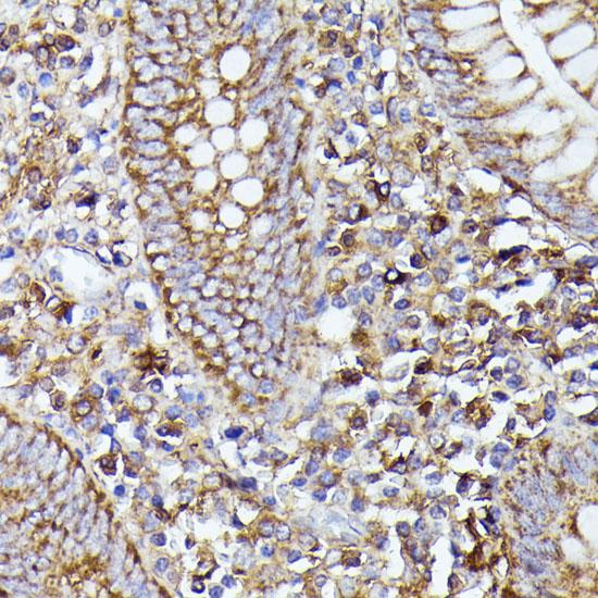 NALP3 / NLRP3 Antibody - Immunohistochemistry of paraffin-embedded Human appendix using NLRP3 Polyclonal Antibody at dilution of 1:100 (40x lens).
