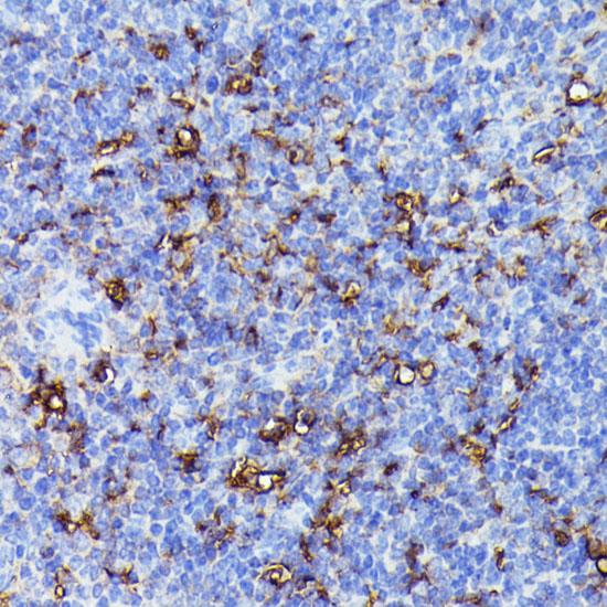 NALP3 / NLRP3 Antibody - Immunohistochemistry of paraffin-embedded Mouse spleen using NLRP3 Polyclonal Antibody at dilution of 1:100 (40x lens).