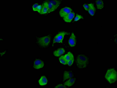 NALP6 / NLRP6 Antibody - Immunofluorescence staining of MCF-7 cells diluted at 1:133, counter-stained with DAPI. The cells were fixed in 4% formaldehyde, permeabilized using 0.2% Triton X-100 and blocked in 10% normal Goat Serum. The cells were then incubated with the antibody overnight at 4°C.The Secondary antibody was Alexa Fluor 488-congugated AffiniPure Goat Anti-Rabbit IgG (H+L).