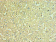 NAMPT / Visfatin Antibody - Immunohistochemistry of paraffin-embedded human liver using antibody at 1:100 dilution.