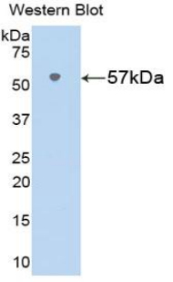 NAMPT / Visfatin Antibody - Western blot of recombinant NAMPT / Visfatin.  This image was taken for the unconjugated form of this product. Other forms have not been tested.