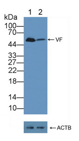 NAMPT / Visfatin Antibody - Knockout Varification: Lane 1: Wild-type 293T cell lysate; Lane 2: VF knockout 293T cell lysate; Predicted MW: 55kd Observed MW: 55kd Primary Ab: 1µg/ml Rabbit Anti-Human VF Antibody Second Ab: 0.2µg/mL HRP-Linked Caprine Anti-Rabbit IgG Polyclonal Antibody