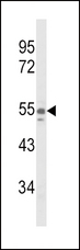 NAMPT / Visfatin Antibody - Western blot of NAMPT Antibody in A375 cell line lysates (35 ug/lane). NAMPT (arrow) was detected using the purified antibody.
