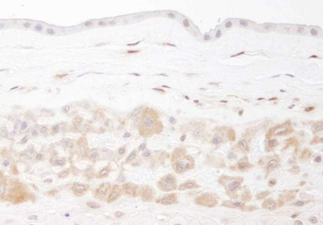 NAMPT / Visfatin Antibody - Detection of Human PBEF by Immunohistochemistry. Sample: FFPE section of human fetal membrane. Antibody: Affinity purified rabbit anti-PBEF used at a dilution of 1:500. Detection: DAB.