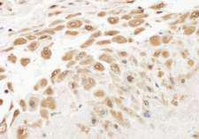 NAMPT / Visfatin Antibody - Detection of Human by Immunohistochemistry. Sample: FFPE section of human placental fetal membrane. Antibody: Affinity purified rabbit anti- used at a dilution of 1:1000 (1 Detection: DAB.