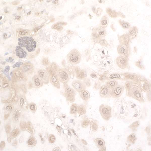 NAMPT / Visfatin Antibody - Detection of human PBEFby immunohistochemistry. Sample: FFPE section of human placental fetal membrane. Antibody: Affinity purified rabbit anti-PBEF used at a dilution of 1:5,000 (0.2µg/ml). Detection: DAB