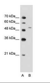 NAMPT / Visfatin Antibody - A: Marker, B: Jurkat Cell Lysate.  This image was taken for the unconjugated form of this product. Other forms have not been tested.