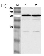 NAMPT / Visfatin Antibody - Western blot analysis of 3T3-L1 cell lysate using anti-Nampt (Visfatin/PBEF) mAb (OMNI379) at 1: 2,000 dilution. 1. IBMX. + DEX. - treated 3T3-L1 cell lysate. 2. IBMX. + DEX. + Insulin - treated 3T3-L1 cell lysate. This image was taken for the unconjugated form of this product. Other forms have not been tested.
