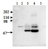 NAMPT / Visfatin Antibody - Immunodetection Analysis: Representative blot from a previous lot. Lane 1.protein marker; Lane 2.Reference control; Lane 3-4.Positive control, Hela and MD231 whole cell lysate; Lane 5.Negative control. The membrane blot was probed with antiVisfatin primary antibody(1µg/ml). Proteins were visualized using a goat anti-rabbit secondary antibody conjugated to HRP and chemiluminescence detection system. Arrows indicate cellular Visfatin from human and mouse cells (52 kDa).