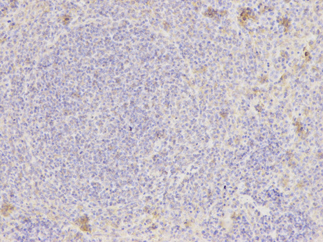 NAMPT / Visfatin Antibody - Immunohistochemistry of paraffin-embedded rat spleen using NAMPT antibody at dilution of 1:200 (200x lens).