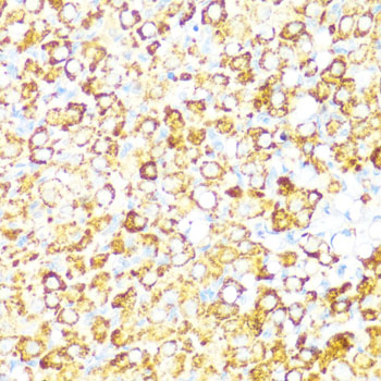 NAMPT / Visfatin Antibody - Immunohistochemistry of paraffin-embedded rat ovary using NAMPT antibodyat dilution of 1:100 (40x lens).