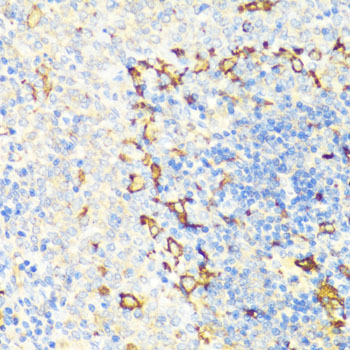 NAMPT / Visfatin Antibody - Immunohistochemistry of paraffin-embedded rat spleen using NAMPT antibodyat dilution of 1:100 (40x lens).