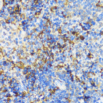 NAMPT / Visfatin Antibody - Immunohistochemistry of paraffin-embedded mouse spleen using NAMPT antibodyat dilution of 1:100 (40x lens).