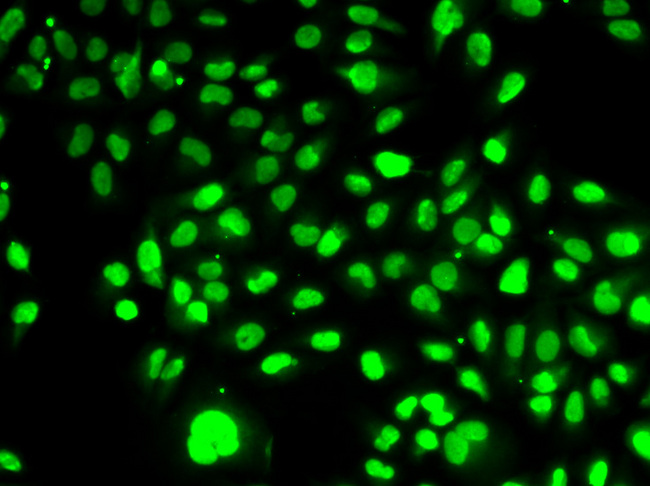 NAMPT / Visfatin Antibody - Immunofluorescence analysis of HeLa cells using NAMPT antibody.