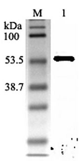 NAMPT / Visfatin Antibody - Western blot analysis using anti-Nampt (rat), pAb at 1:2000 dilution. 1: Rat Nampt (His-tagged).