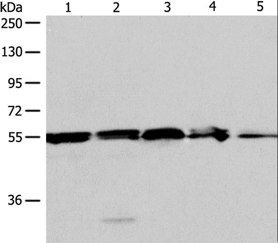NAMPT / Visfatin Antibody - Western blot analysis of A375, 293T cell and mouse liver tissue, Jurkat cell and human fetal kidney tissue, using NAMPT Polyclonal Antibody at dilution of 1:700.
