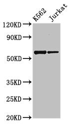 NAMPT / Visfatin Antibody - Western Blot Positive WB detected in:K562 whole cell lysate,Jurkat whole cell lysate All Lanes:NAMPT antibody at 2.7µg/ml Secondary Goat polyclonal to rabbit IgG at 1/50000 dilution Predicted band size: 56 KDa Observed band size: 56 KDa