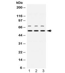 NAMPT / Visfatin Antibody - Western blot testing of 1) rat brain, 2) mouse heart and 3) human placenta lysate with Visfatin antibody at 0.5ug/ml. Expected molecular weight ~56 kDa.