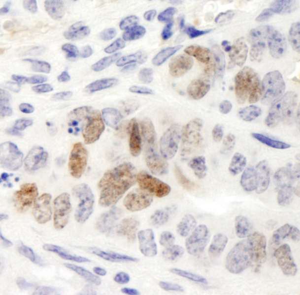 NANOG Antibody - Detection of Mouse Nanog by Immunohistochemistry. Sample: FFPE section of mouse teratoma. Antibody: Affinity purified rabbit anti-Nanog used at a dilution of 1:250. Epitope Retrieval Buffer-High pH (IHC-101J) was substituted for Epitope Retrieval Buffer-Reduced pH.
