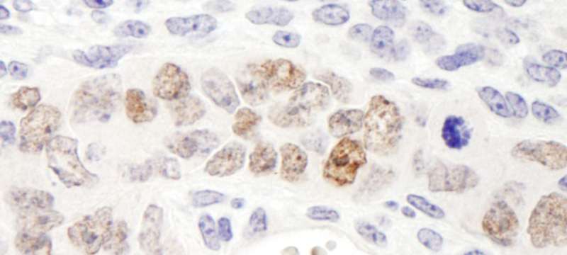 NANOG Antibody - Detection of Mouse Nanog by Immunohistochemistry. Sample: FFPE section of mouse teratoma. Antibody: Affinity purified rabbit anti-Nanog used at a dilution of 1:500 (2 ug/ml). Detection: DAB.