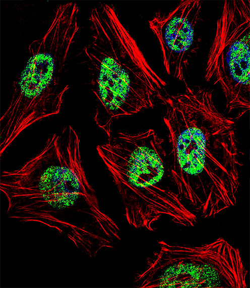NANOG Antibody - Fluorescent confocal image of HeLa cell stained with NANOG Antibody. HeLa cells were fixed with 4% PFA (20 min), permeabilized with Triton X-100 (0.1%, 10 min), then incubated with NANOG primary antibody (1:25, 1 h at 37°C). For secondary antibody, Alexa Fluor 488 conjugated donkey anti-rabbit antibody (green) was used (1:400, 50 min at 37°C). Cytoplasmic actin was counterstained with Alexa Fluor 555 (red) conjugated Phalloidin (7units/ml, 1 h at 37°C). Nuclei were counterstained with DAPI (blue) (10 ug/ml, 10 min). NANOG immunoreactivity is localized to Nucleus significantly.
