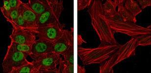 NANOG Antibody - Immunocytochemistry/Immunofluorescence: Nanog Antibody (1E6C4) - Confocal immunofluorescence analysis of NTERA-2 cells (left) and HeLa cells (right) using anti-Nanog Mouse mAb (green). Red: Actin filaments have been labeled with DY-554 phalloidin.