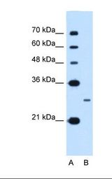 NANOG Antibody - Lane A: Marker. Lane B: Jurkat cell lysate. Antibody concentration: 0.25 ug/ml. Gel concentration: 12%.  This image was taken for the unconjugated form of this product. Other forms have not been tested.