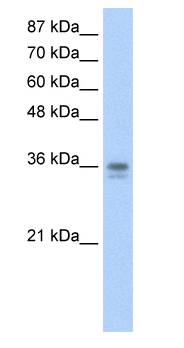 NANOG Antibody - Western blot of HepG2 cell lysate.  This image was taken for the unconjugated form of this product. Other forms have not been tested.