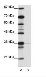 NANOG Antibody - A: Marker, B: Jurkat Cell Lysate.  This image was taken for the unconjugated form of this product. Other forms have not been tested.