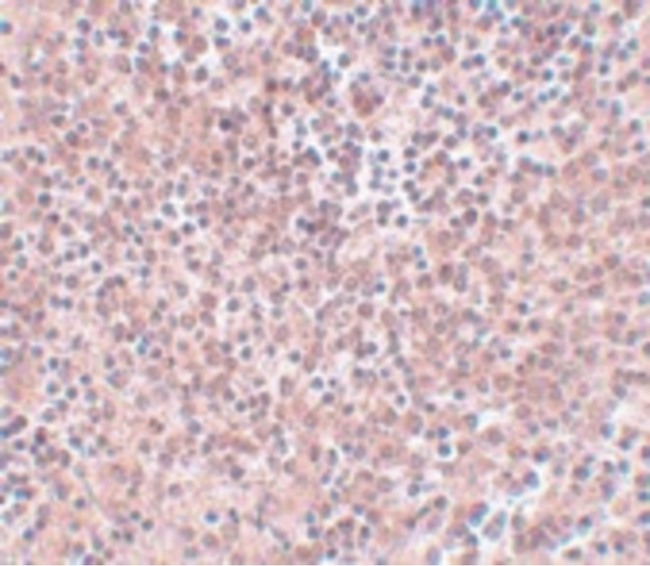 NANOG Antibody - Immunohistochemistry of NANOG in human spleen tissue with NANOG antibody at 5 ug/ml.