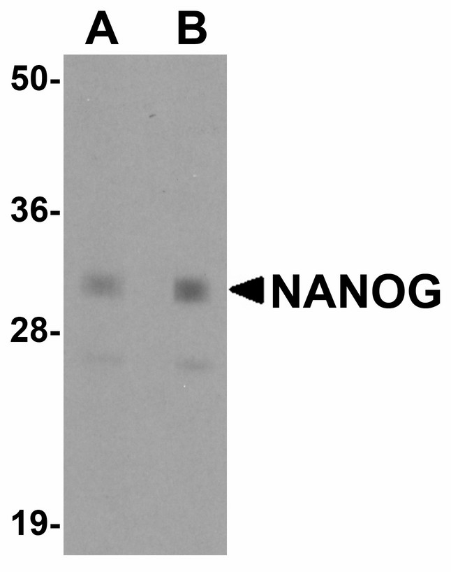 NANOG Antibody - Western blot of NANOG in human spleen tissue lysate with NANOG antibody at (A) 1 and (B) 2 ug/ml.