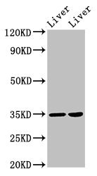 NANOG Antibody - Western Blot Positive WB detected in:Rat liver tissue,Mouse liver tissue All Lanes:NANOGP8 antibody at 2µg/ml Secondary Goat polyclonal to rabbit IgG at 1/50000 dilution Predicted band size: 35 KDa Observed band size: 35 KDa