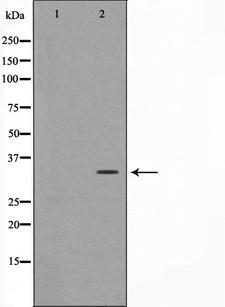 NANOG Antibody - Western blot analysis of Nanog expression in human ovary lysate. The lane on the left is treated with the antigen-specific peptide.