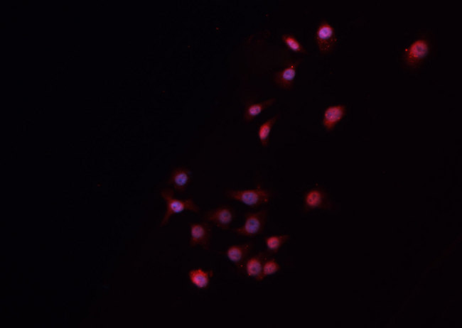 NANOG Antibody - Staining 3T3 cells by IF/ICC. The samples were fixed with PFA and permeabilized in 0.1% Triton X-100, then blocked in 10% serum for 45 min at 25°C. The primary antibody was diluted at 1:200 and incubated with the sample for 1 hour at 37°C. An Alexa Fluor 594 conjugated goat anti-rabbit IgG (H+L) antibody, diluted at 1/600, was used as secondary antibody.