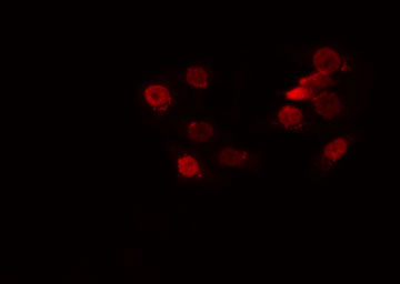 NANOG Antibody - Staining HuvEc cells by IF/ICC. The samples were fixed with PFA and permeabilized in 0.1% Triton X-100, then blocked in 10% serum for 45 min at 25°C. The primary antibody was diluted at 1:200 and incubated with the sample for 1 hour at 37°C. An Alexa Fluor 594 conjugated goat anti-rabbit IgG (H+L) Ab, diluted at 1/600, was used as the secondary antibody.