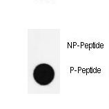 NANOG Antibody - Dot blot of anti-Phospho-Nanog-S285 Antibody on nitrocellulose membrane. 50ng of Phospho-peptide or Non Phospho-peptide per dot were adsorbed. Antibody working concentrations are 0.5ug per ml.