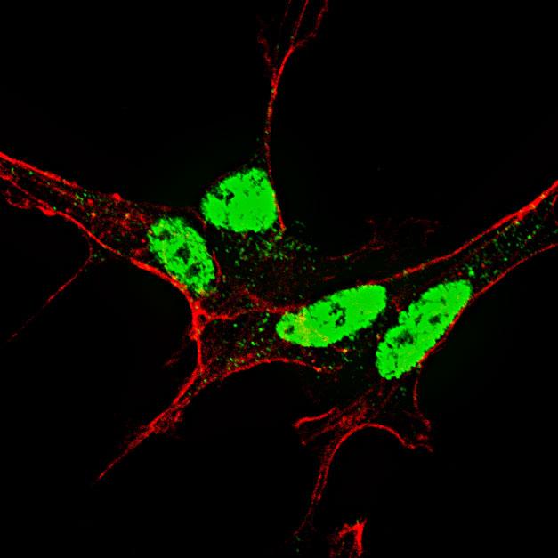 NANOG Antibody - Fluorescent confocal image of SY5Y cells stained Phospho-Nanog-S71 antibody. SY5Y cells were fixed with 4% PFA (20 min), permeabilized with Triton X-100 (0.2%, 30 min), then incubated Phospho-Nanog-S71 primary antibody (1:500, 2 h at room temperature). For secondary antibody, Alexa Fluor 488 conjugated donkey anti-rabbit antibody (green) was used (1:1000, 1h). Cytoplasmic actin was counterstained with Alexa Fluor 555 (red) conjugated Phalloidin (5.25 mu M, 25 min). Phospho-Nanog immunoreactivity is localized very specifically to the nuclei of the SY5Y cells.