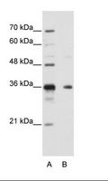 NANOS1 / NOS1 Antibody - B: HepG2 Cell Lysate.  This image was taken for the unconjugated form of this product. Other forms have not been tested.