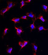 NANOS1 / NOS1 Antibody - Immunofluorescence of anti-NANOS1 Antibody in HeLa cells. 0.025 mg/ml primary antibody was followed by Alexa-Fluor-546-conjugated donkey anti-rabbit lgG (H+L). Alexa-Fluor-546 emits orange fluorescence. Blue counterstaining is DAPI.