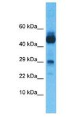 NANOS1 / NOS1 Antibody - NANOS1 / NOS1 antibody Western Blot of Thymus Tumor. Antibody dilution: 1 ug/ml.  This image was taken for the unconjugated form of this product. Other forms have not been tested.