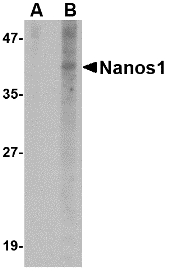 NANOS1 / NOS1 Antibody - Western blot of Nanos1 in SK-N-SH cell lysate with Nanos1 antibody at 1 ug/ml in (A) the presence and (B) the absence of blocking peptide.